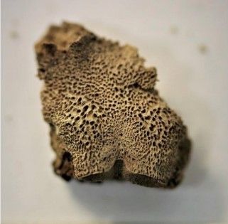 Muestras óseas que indican irregularidades en el hueso occipital (imagen superior) y escápula (inferior) en individuos con trisomía 21.