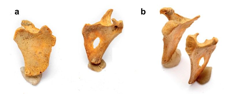 Muestras óseas que indican irregularidades en el hueso occipital (imagen superior) y escápula (inferior) en individuos con trisomía 21.